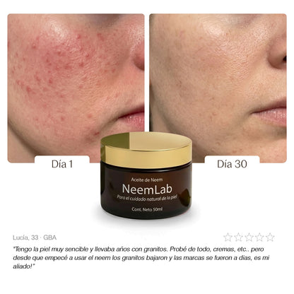 Neem Purificante I Aceite natural para piel con acné