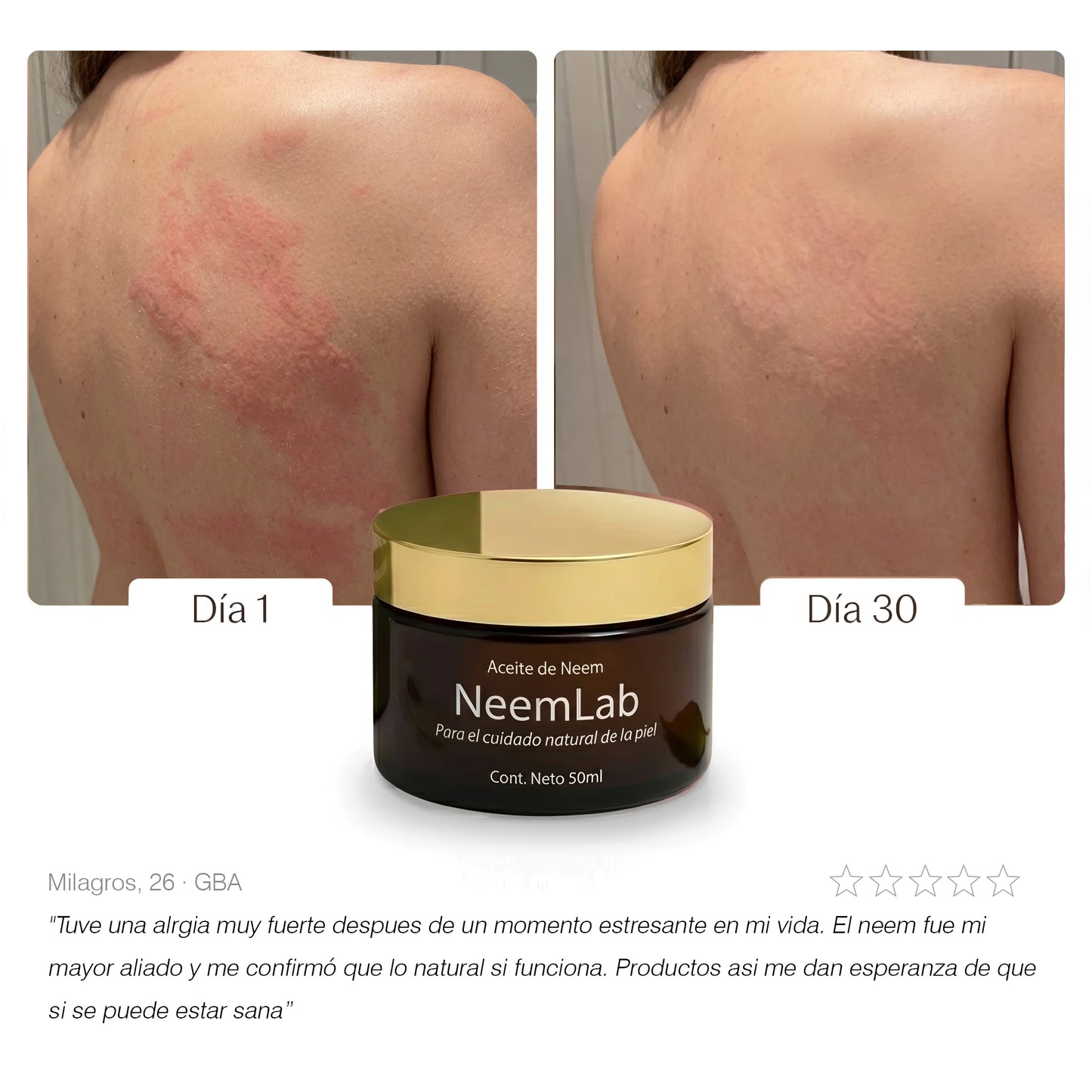 Neem Calmante I Aceite natural para piel irritada
