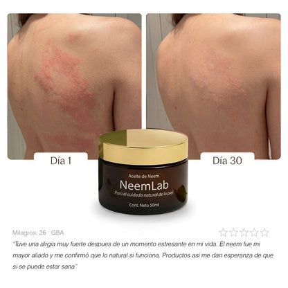 Neem Calmante I Aceite natural para piel irritada